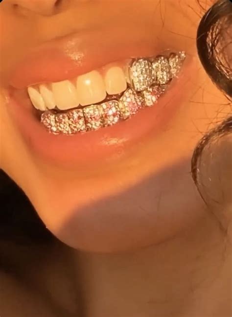 tadiorx 🧩 grills teeth diamond grillz teeth jewelry