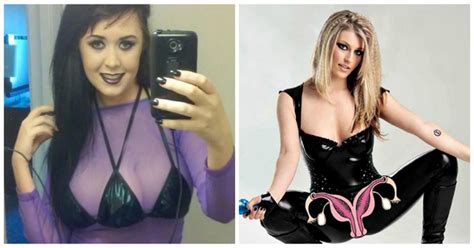 Special People With Unusual And Extra Body Parts