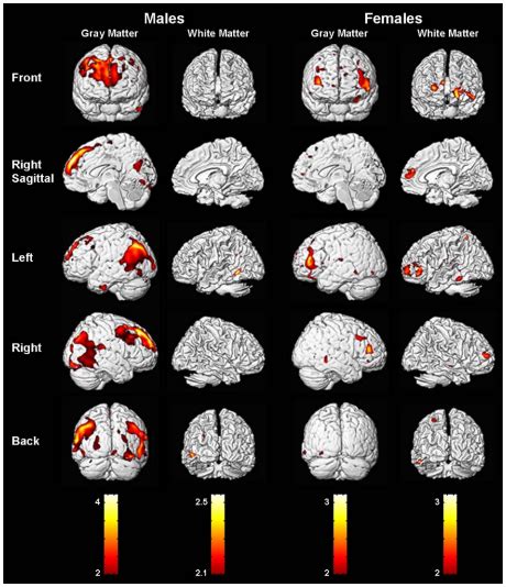 Adventures In Antimisandry Sex Differences In The Brain