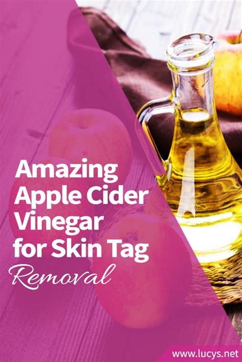 how to use apple cider vinegar for skin tag removal step by step