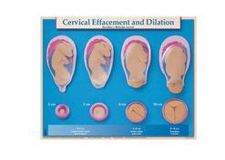 childbirth today  ways  teach  cervical dilation