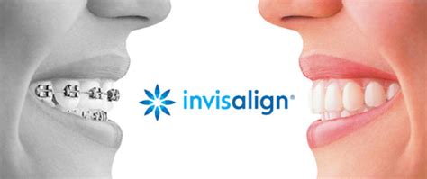 invisalign  holly springs klooster family dentistry