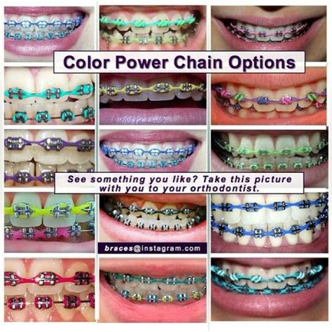 color power chains braces tips cute braces braces colors
