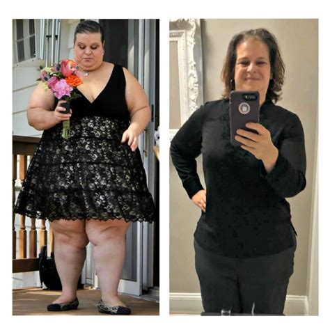 Kimberly Celebrates 215 Pound Weight Loss After Gastric