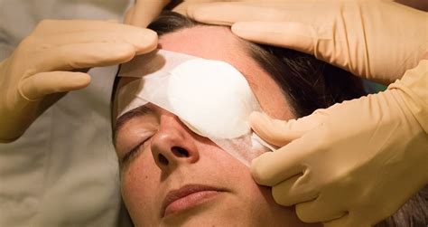 cataract surgery recovery immediately  surgery