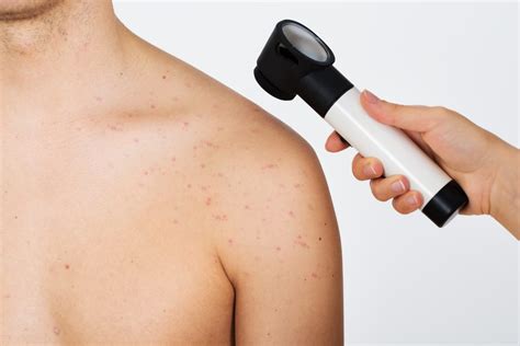 skin biopsy litchfield park dermatologist clear sky dermatology