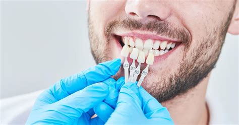porcelain dental veneers benefits and disadvantages