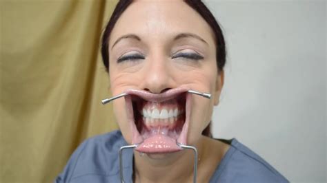 amazing cheek retractor bondage