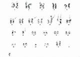 Karyotype Abnormal Chromosome Complex Abnormalities Structural sketch template