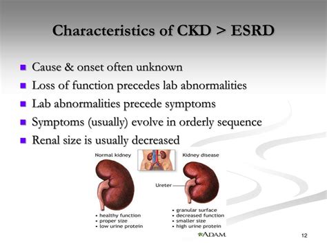 Ppt Ckd Esrd And Management Powerpoint Presentation Free Download Id