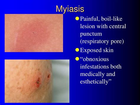 rash overview  tropical skin diseases