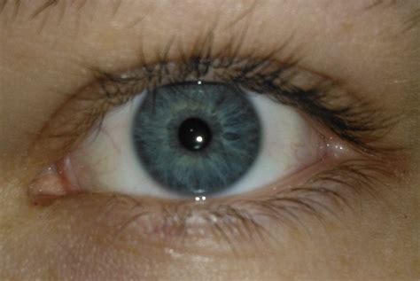 my eye blue with a little bit of yellow eyes