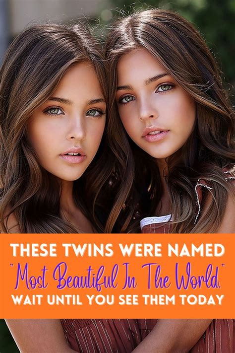 These Twins Were Named Most Beautiful In The World Wait Until You