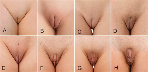 Poll Labia Minora From Hidden To Large Take Your Pick
