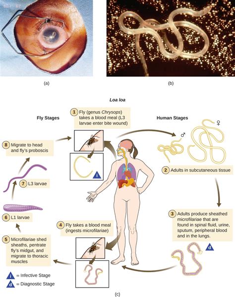 Protozoan And Helminthic Infections Of The Skin And Eyes Microbiology