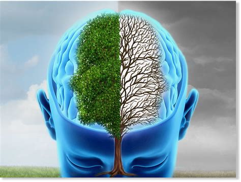 understanding  bipolar brain   keys  unlocking treatment   health wellness