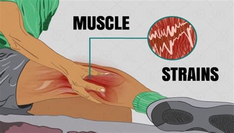 effective physical therapy tips    recover  muscle strain