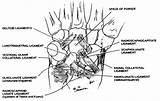Ligaments Wrist Ligament Scapholunate Poirier Orthobullets Instability Biomechanics Dorsal Triquetrum sketch template