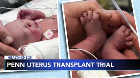 Penn Medicine Successfully Performs Two Uterus Transplants 6abc