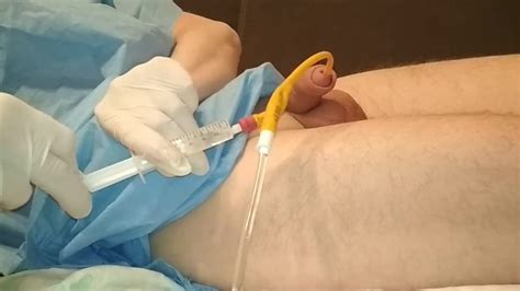 removal catheter thumbzilla