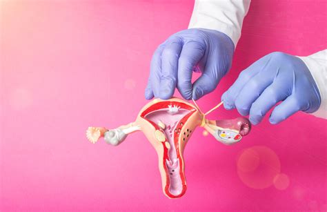 tubal ligation should you get your tubes tied advanced obgyn institute