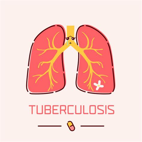 royalty  mycobacterium tuberculosis clip art vector images