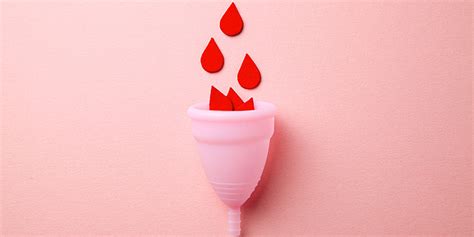 spiraal  ablatie bij hevig menstrueel bloedverlies huisarts wetenschap