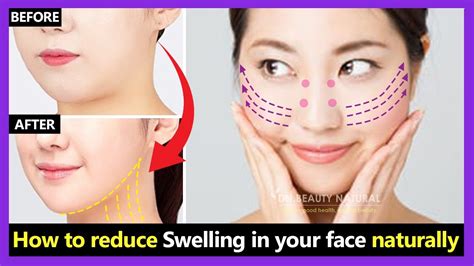 how to reduce swelling face face bloating quickly and slim down puffy