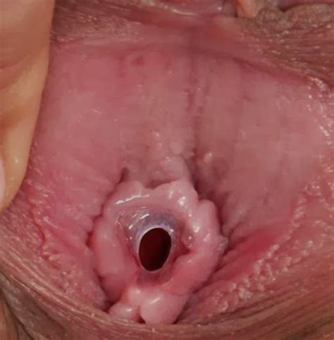 virgin hymen defloration xnxx adult forum