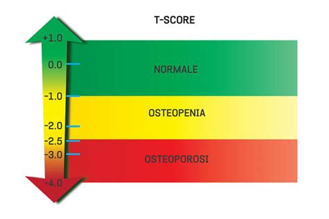score  score bone density