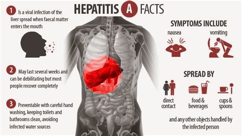 How Can You Recognize Hepatitis A Symptoms And Diagnosis Hepatitis
