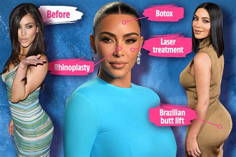 i m a plastic surgeon signs kim kardashian s had up to 170 000 in