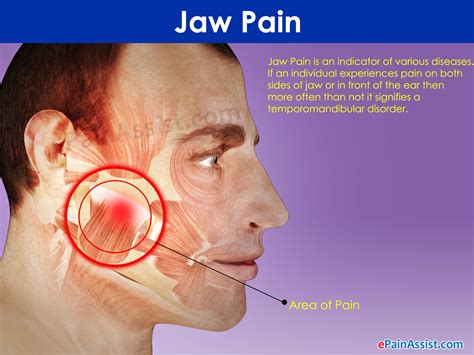 jaw pain medical conditions    painful jaw