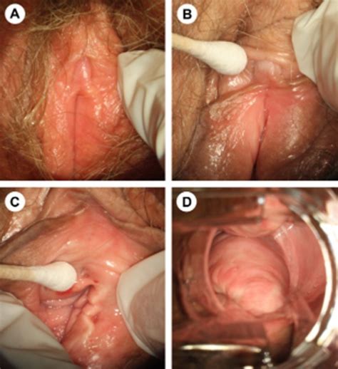 penis and vulva mature milf