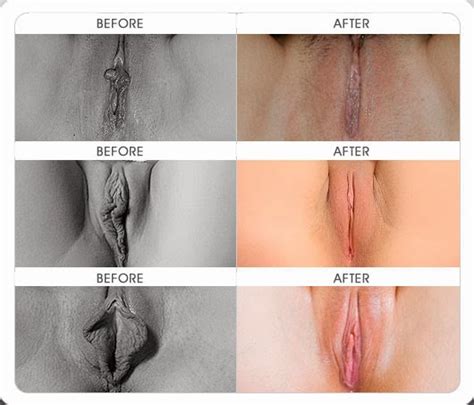 Vagina Before And After Sex Voyeur Rooms
