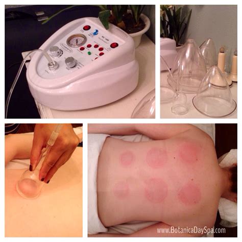 cupping massage now available at botanica day spa botanica day spa