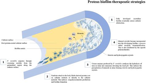 proteus vulgaris gram stain billabite