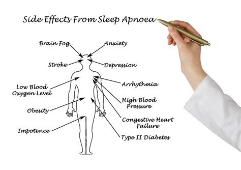 Stop Sleep Apnoea Causes And Treatment Tmj Centre Melbourne