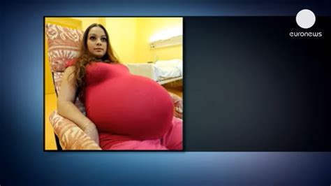 Pregnant Mom Thinks Shes Having Twins But She Breaks Countrys Record