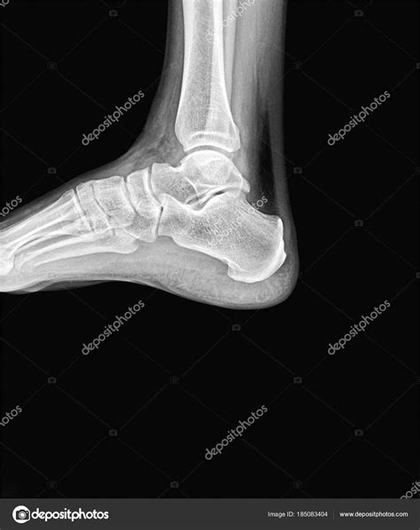 man  ankle ray side scan stock photo  cjovannig