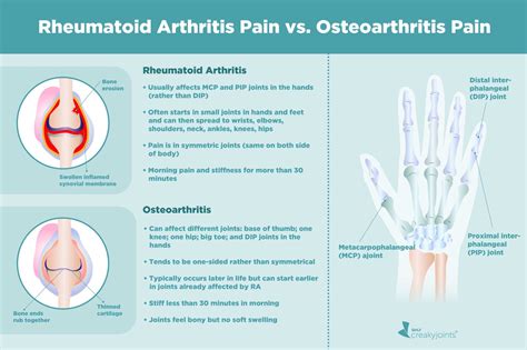 rheumatoid arthritis pain   inflammation