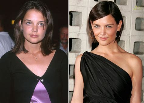 14 celebrities before and after plastic surgery gallery ebaum s world