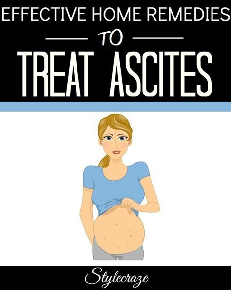 Ascites Causes Symptoms Treatments And Home Remedies Home