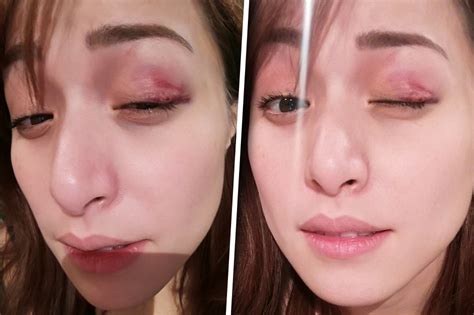 Ouch Cristine Reyes Left With Bruise After Getting Kicked