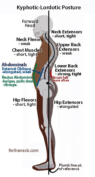 Total Athletic Therapy Mobility Monday The Twin Bowstrings The Psoas