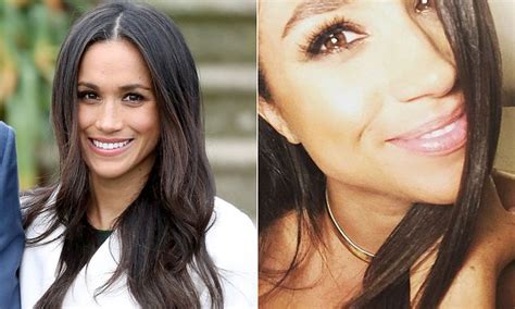meghan markle effect sees more women requesting nose jobs