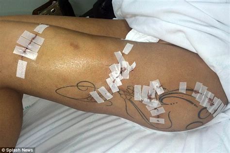 miss bumbum s andressa urach back in hospital with infected buttock implant daily mail online