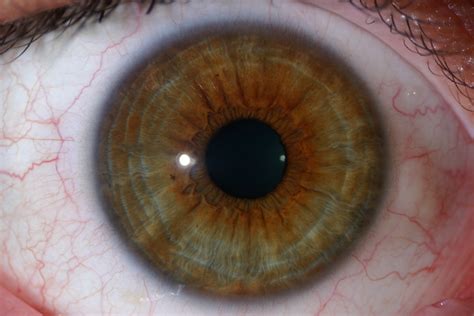 iridology yellow ring  pupil maikong iridology cameras iriscope leading