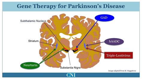 New Meds For Parkinson S Disease Quotes Update Viral