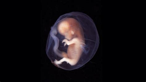study human embryos   days nova  pbs